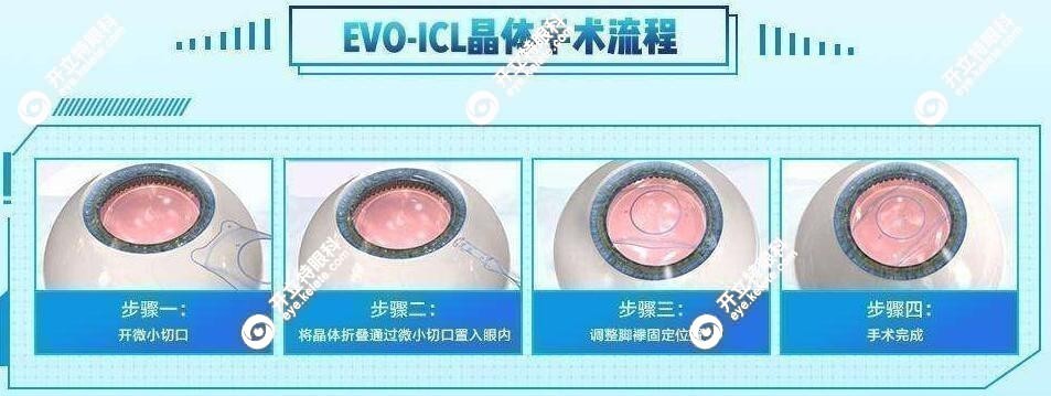 ICL晶体植入近视手术价格2.5万元起
