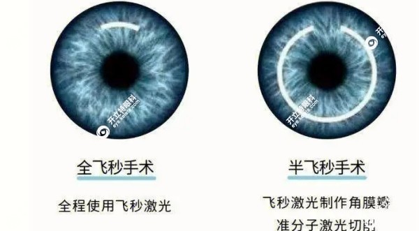 参军建议全飞秒还是半飞秒fakemusicmedia.com