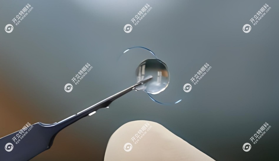 ICL人工晶体植入手术适用人群
