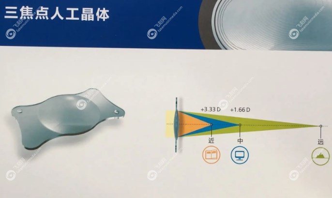 爱尔康三焦点人工晶体怎么样