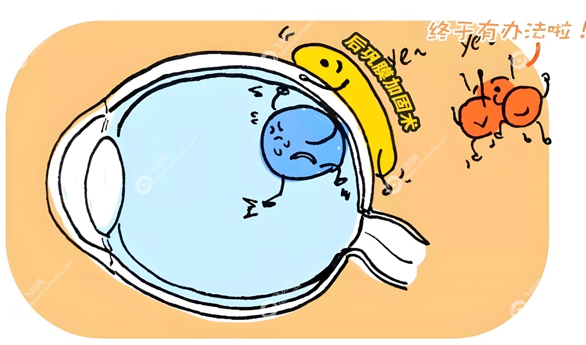 后巩膜加固手术瞎了是谣言