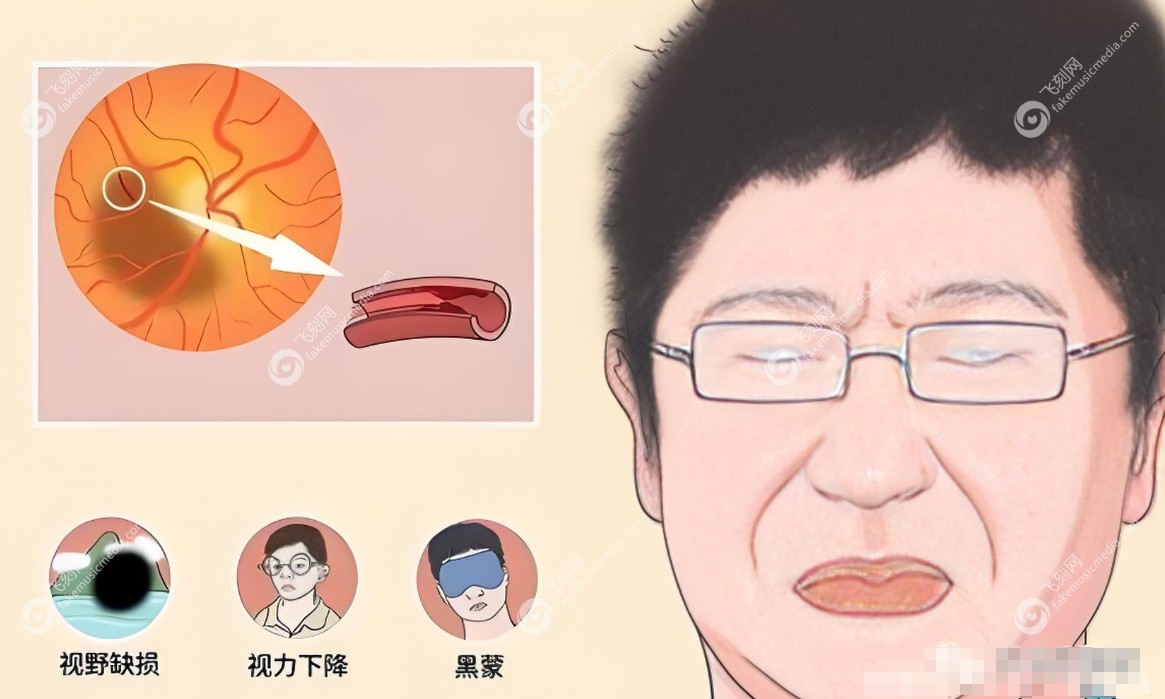 视神经萎缩失明www.fakemusicmedia.com