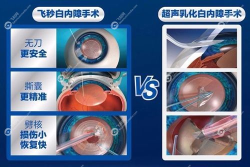 普瑞眼科医院眼病手术收费价目表