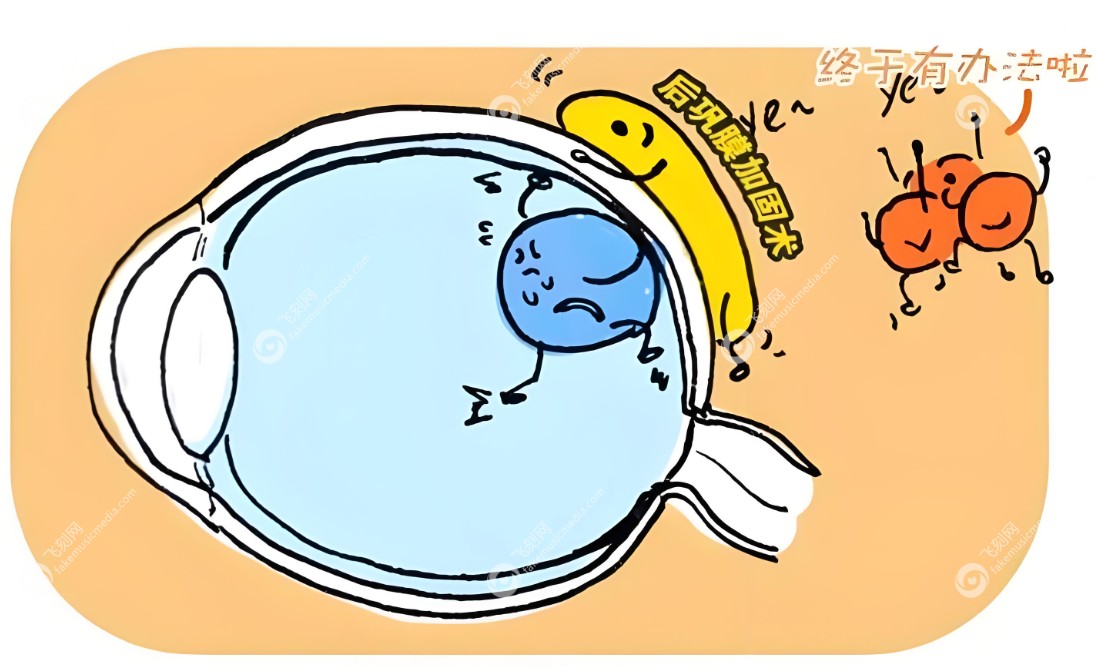 王乐今后巩膜加固术的优势