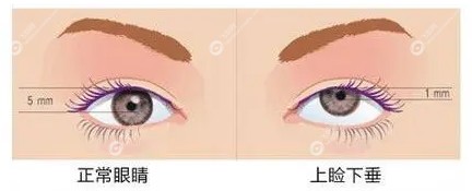 北京美和眼科医院于刚医生怎么样