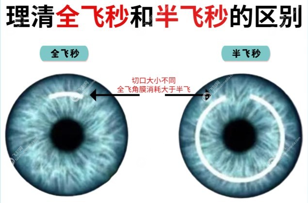 广州佰视佳眼科全飞秒