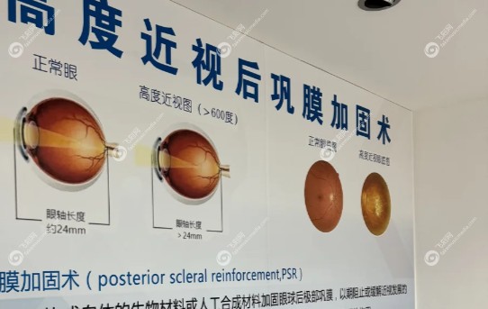 北京熙仁眼科