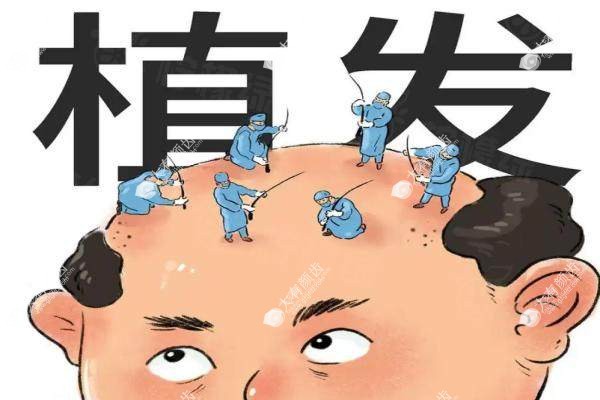 fue植发手术过程