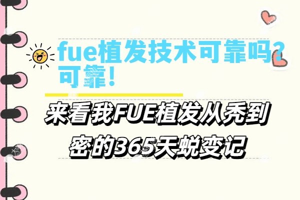fue植发技术可靠吗