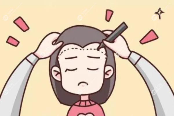 植发毛囊还能再长出来吗