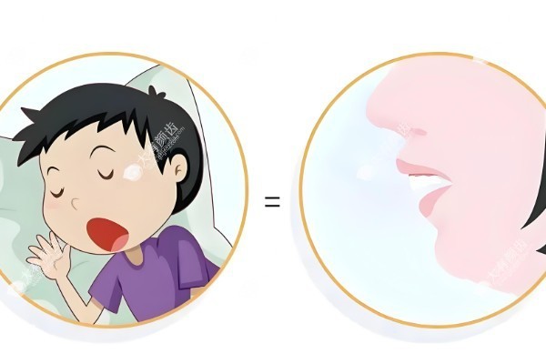 儿童长期用口呼吸有什么危害fakemusicmedia.com
