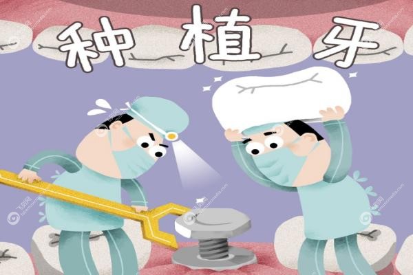 以色列雅定种植体多少钱一颗.jpg