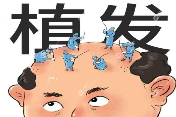 成都恒博植发多少钱