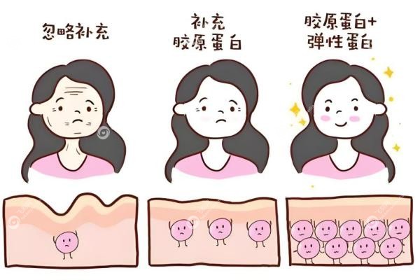 国产注射胶原蛋白品牌有哪些?薇旖美