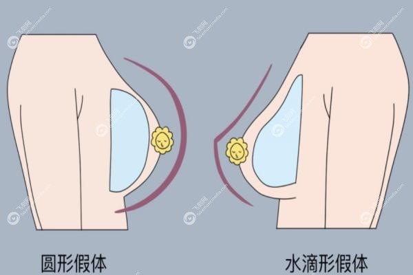 隆胸假体进口品牌十大排行榜.jpg