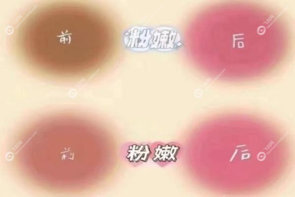 私密粉嫩针和漂红的区别.jpg
