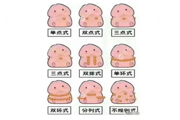 入珠手术哪个医院可以做.jpg