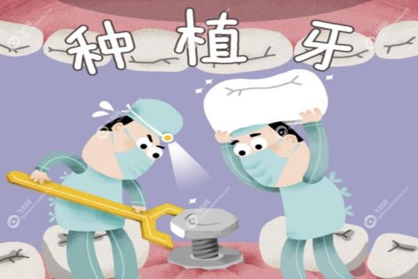 日本为什么不建议种植牙.jpg