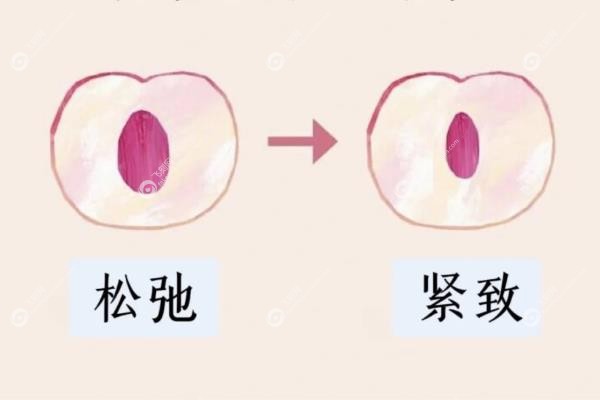 国内打紧缩针美容手术医院排名
