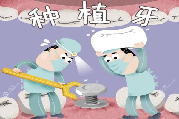 老人种植牙价格表.jpg