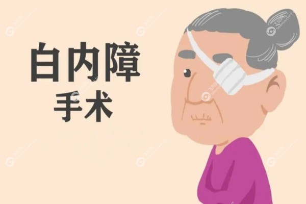 白内障手术免费政策2025还免费吗3.jpg