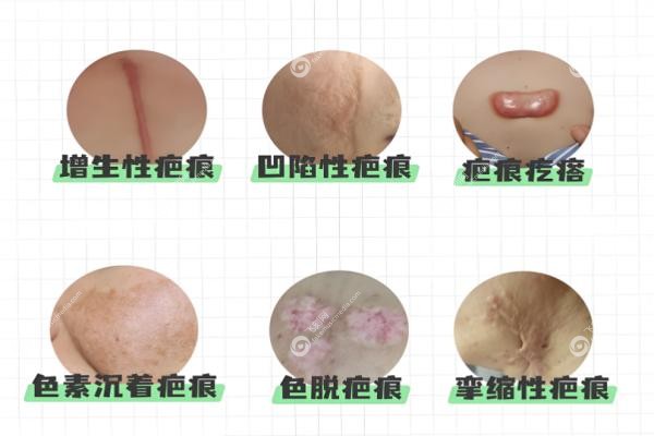 成都友谊医院疤痕科地址电话