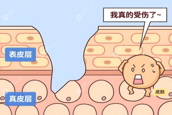 成都友谊医院疤痕科预约挂号流程