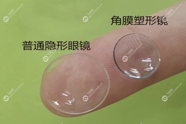 角膜塑形镜价格一览表20252.jpg