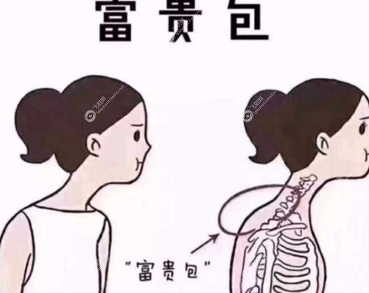 黄学峰富贵包.jpg