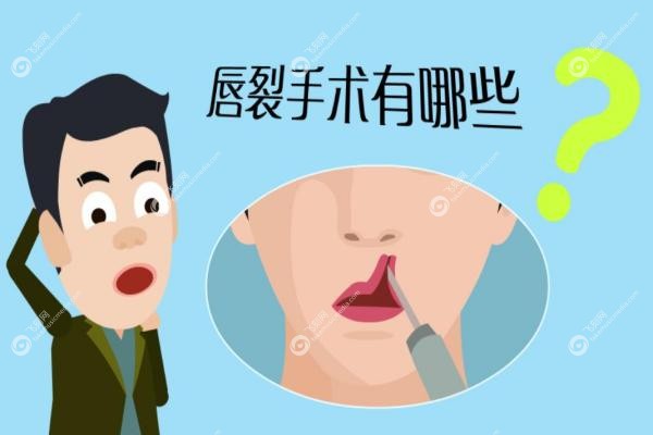 全 国修复唇裂医院排名.jpg