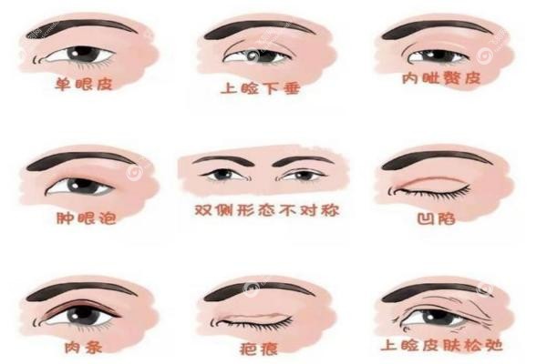 吴焱秋修复到底好不好？修复贵但值！吴焱秋2000例0失败背后的秘密