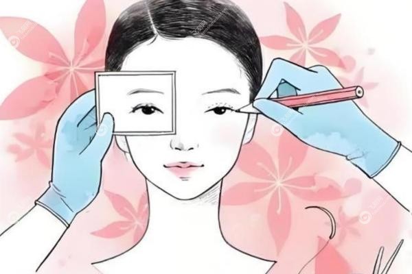 常冬青修复双眼皮怎么样?毫米级修复术