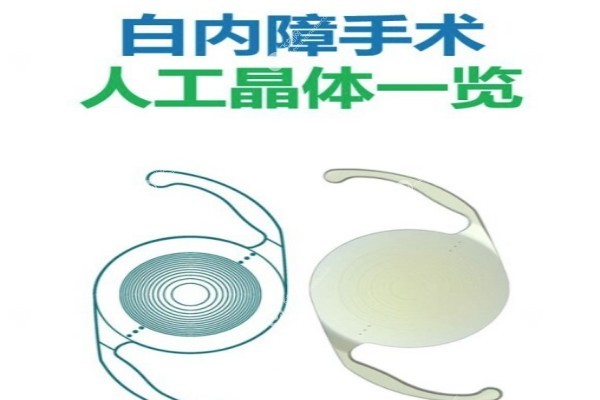 白内障人工晶体2025价目表1.jpg