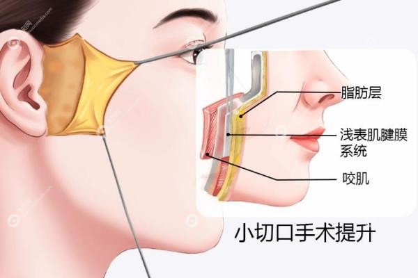 重庆拉皮手术医生排名前十：倪锋隐痕术VS郑荃八爪鱼,谁适合你？2