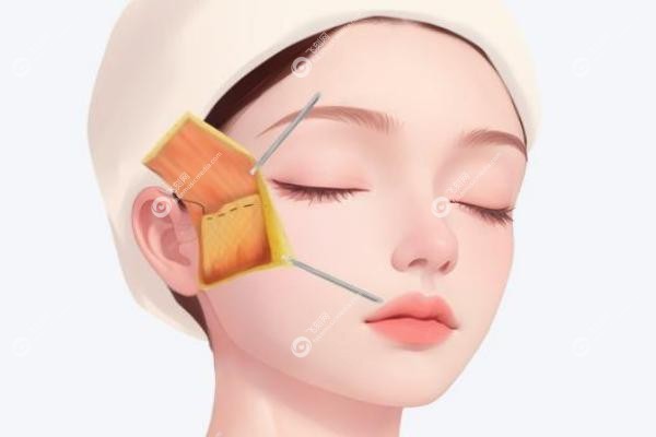 王召东医生怎么样yimei.fakemusicmedia.com20250617693205.jpg