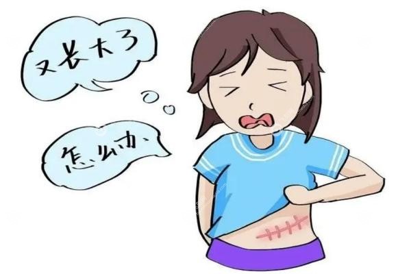 广州治疗疤痕疙瘩哪家医院好.jpg