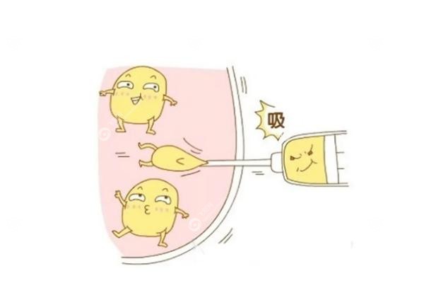 乌鲁木齐抽脂哪家医院做的好.jpg