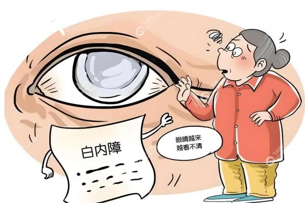 江苏白内障免费政策全攻略:手术费用
