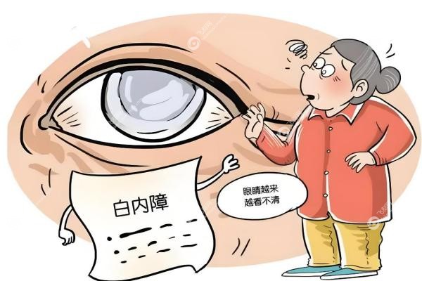进口三焦晶体的品牌排行榜：蔡司/爱尔康/眼力健等深度评测,看完秒懂怎么选!3