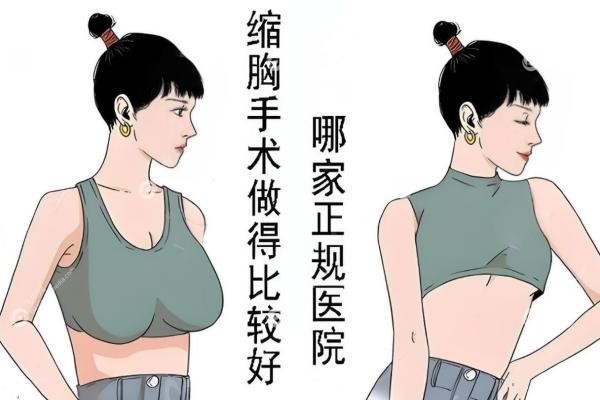  北京做缩胸手术哪个医院好？这10家医院技术超稳！疤痕浅/胸型美/价格一览1