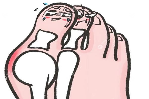 北京苏敬达医生广告这么多靠谱吗？大脚骨手术真实案 例+技术口碑全解析