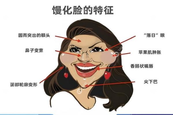 维密金雕真能拯救馒化脸？手术过程/恢 复期/面罩佩戴全攻略2