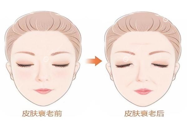 北京王志坚无痕筋膜提升怎么样？30年经验+微创技术,保持时间久,真实案 例揭秘！3