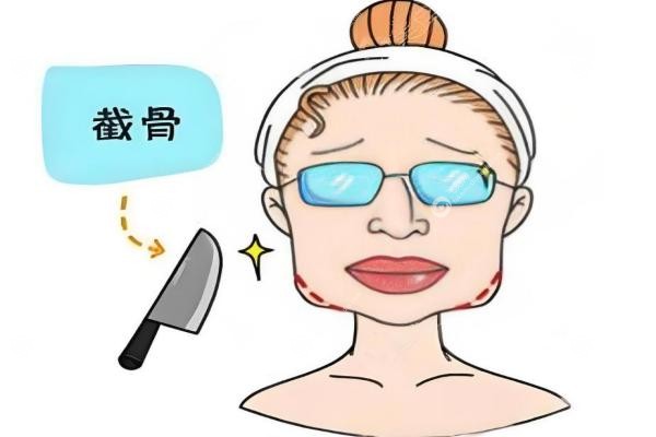 河东镐磨骨技术怎么样？自然/精 准/稳！高端档次，值不值这个价？案 例说话
