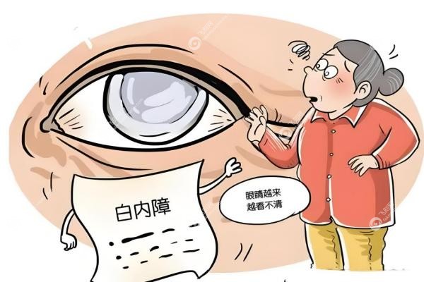 白内障手术选进口还是国产晶体？一篇看懂区别，帮你省心又省钱！