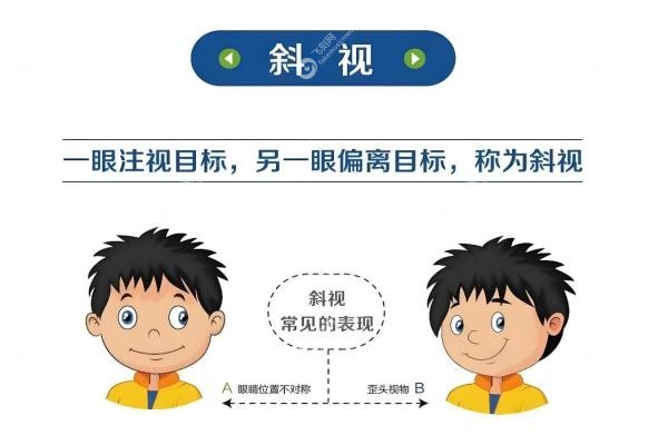 儿童/成人斜视能矫正过来吗？一只眼斜/外斜/天生斜视矫正法+手术年龄费用揭秘！3