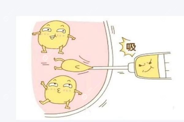 武汉抽脂丛晓斌手术<span style=