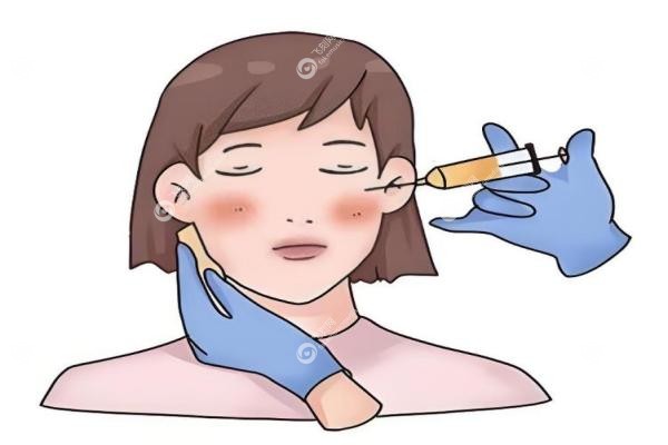 玻尿酸品牌排行榜前十名：乔雅登/瑞蓝/艾莉薇等深度对比，轻松get自然妈生感！3