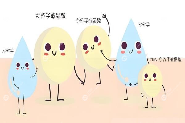 玻尿酸品牌排行榜前十名：乔雅登/瑞蓝/艾莉薇等深度对比，轻松get自然妈生感！2