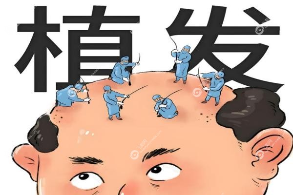 北京徐霞头发移植怎么样？技术强/口碑好/价格透明，秃头救星亲测有效！